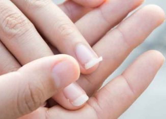A “pretty” solution for brittle and fragile nails