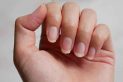 How to treat damaged nails?