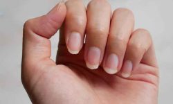 How to treat damaged nails?