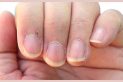 What are cuticles?