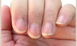 What are cuticles?