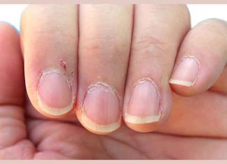 What are cuticles?